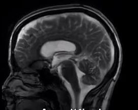 Blurred BRAIN meme template